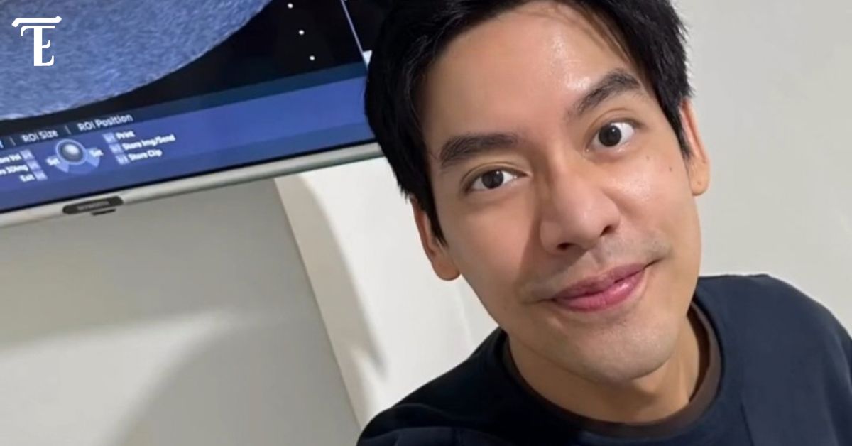 Unggah Video USG, Tae Darvid Akan Menjadi Seorang Ayah